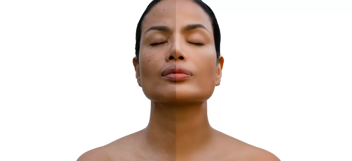 5 consigli per prevenire e ridurre le macchie solari