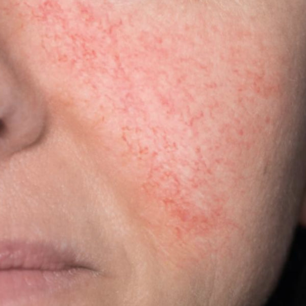 Describes the appearance of the image